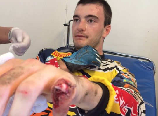 La lesión de Herlings, horribles imágenes.